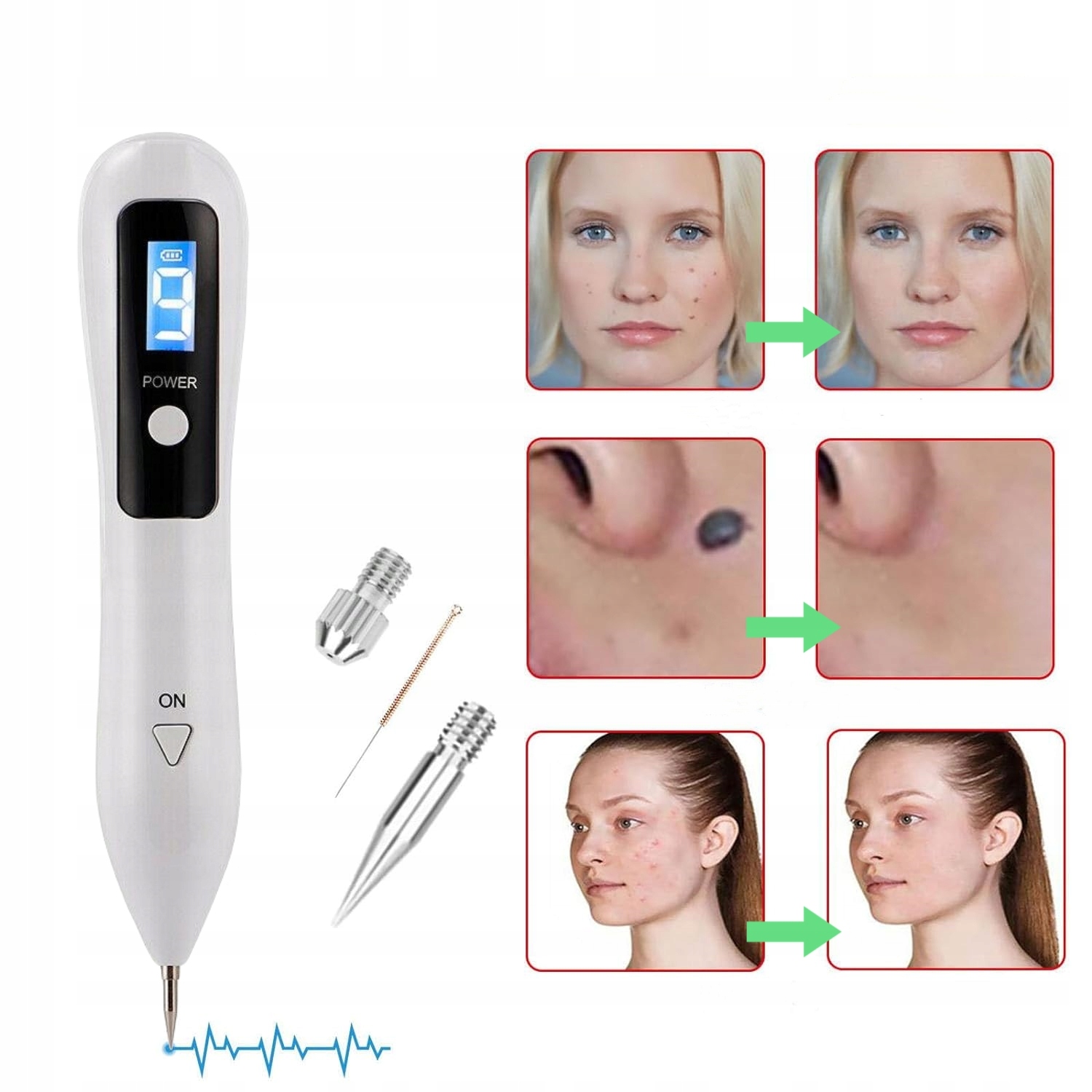 professional spot remover elektrokoagulator Laser pen Zasilanie sieciowe sieciowo-akumulatorowe