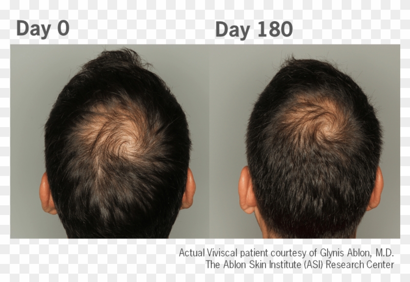 VIVISCAL SUPLEMENT WZROSTU WŁOSÓW dla mężczyzn 180 Nazwa Man Hair Growth Program