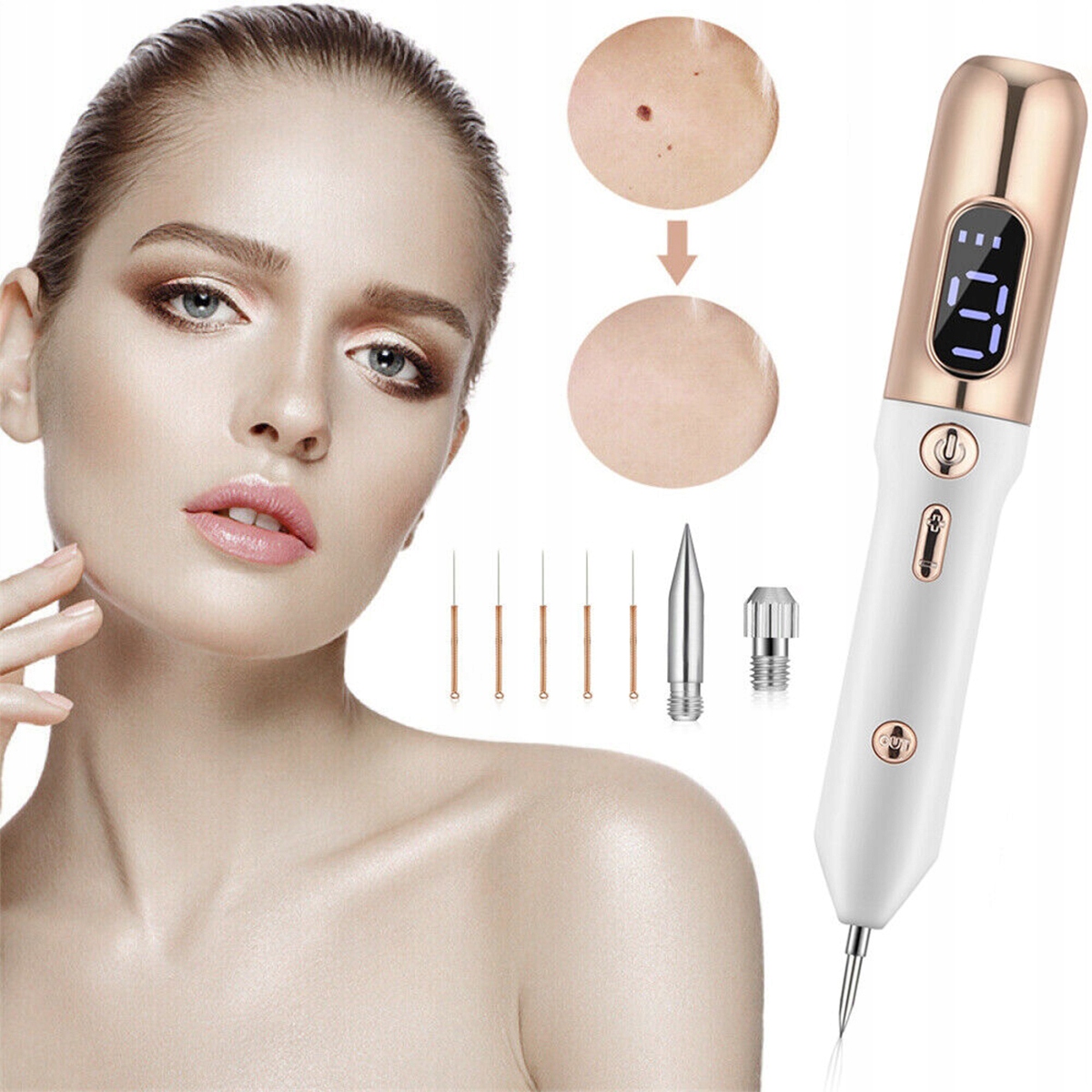 Plazma Pen Laser Spot Remover Plasma zapisuje krtkům tetování