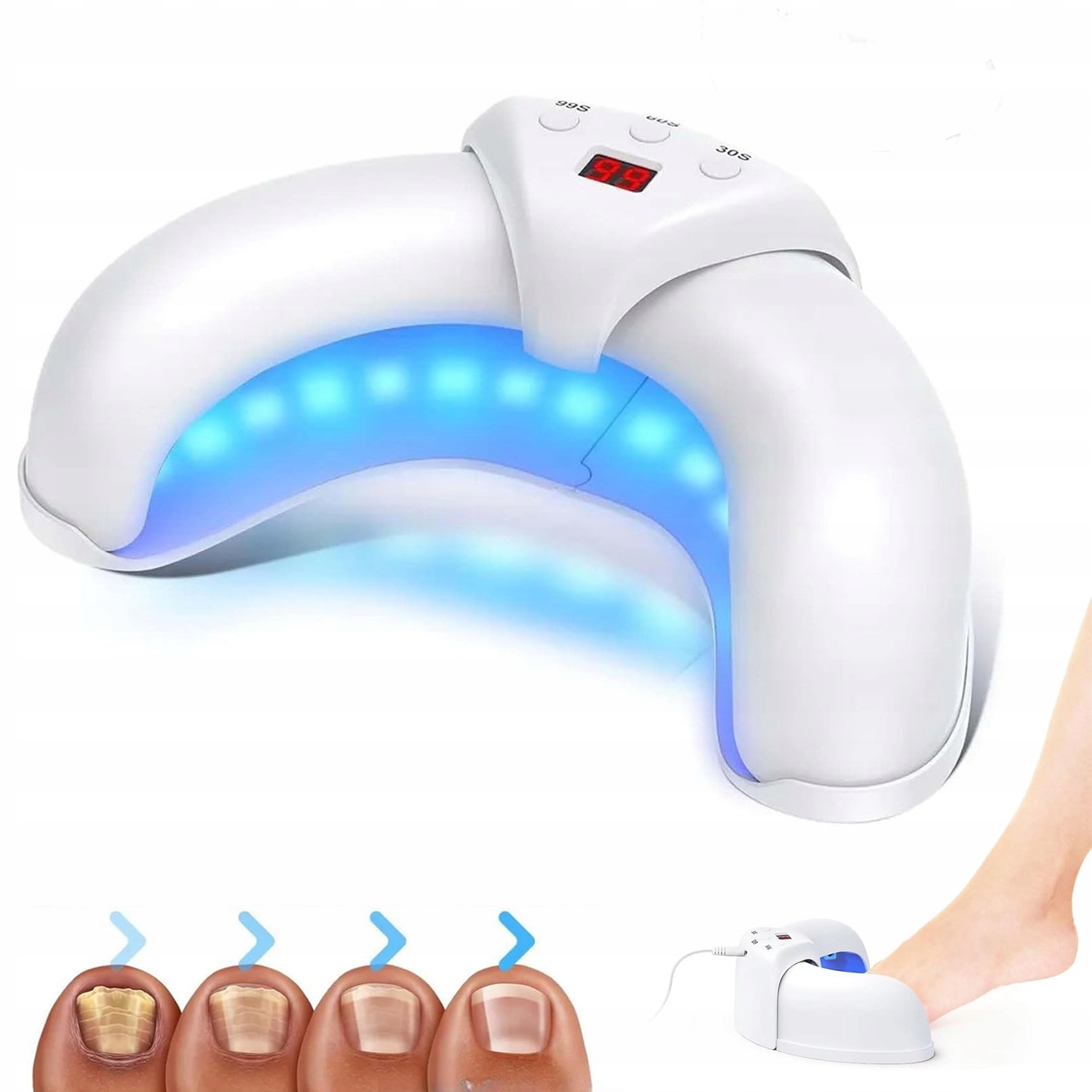 Laserové Zařízení Pro Léčbu Mykózy Nehtů, Bezbolestné, Účinné