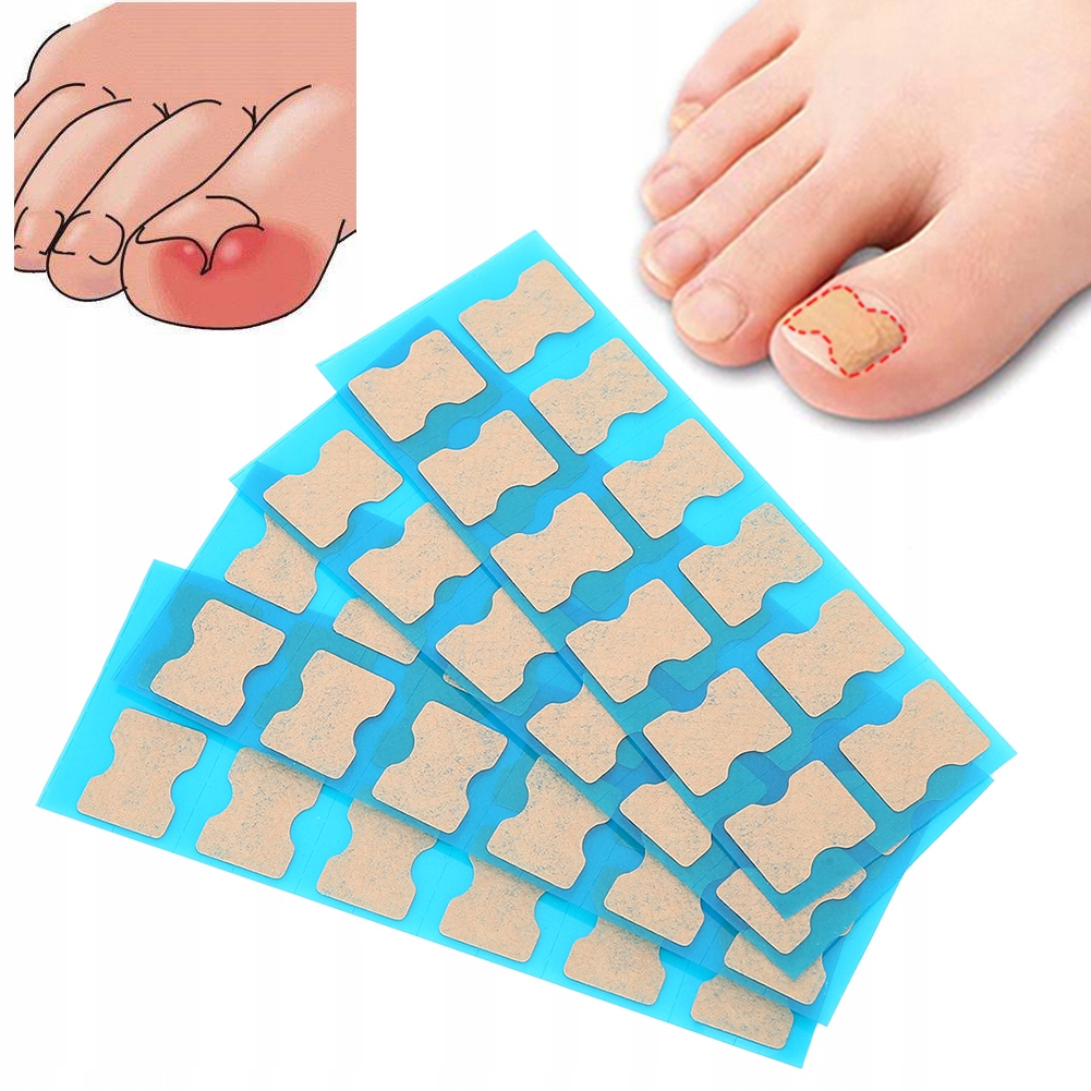 48 X PASKI ŁATKI NA WRASTAJĄCE PAZNOKCIE PLASTRY Wyrób medyczny nie