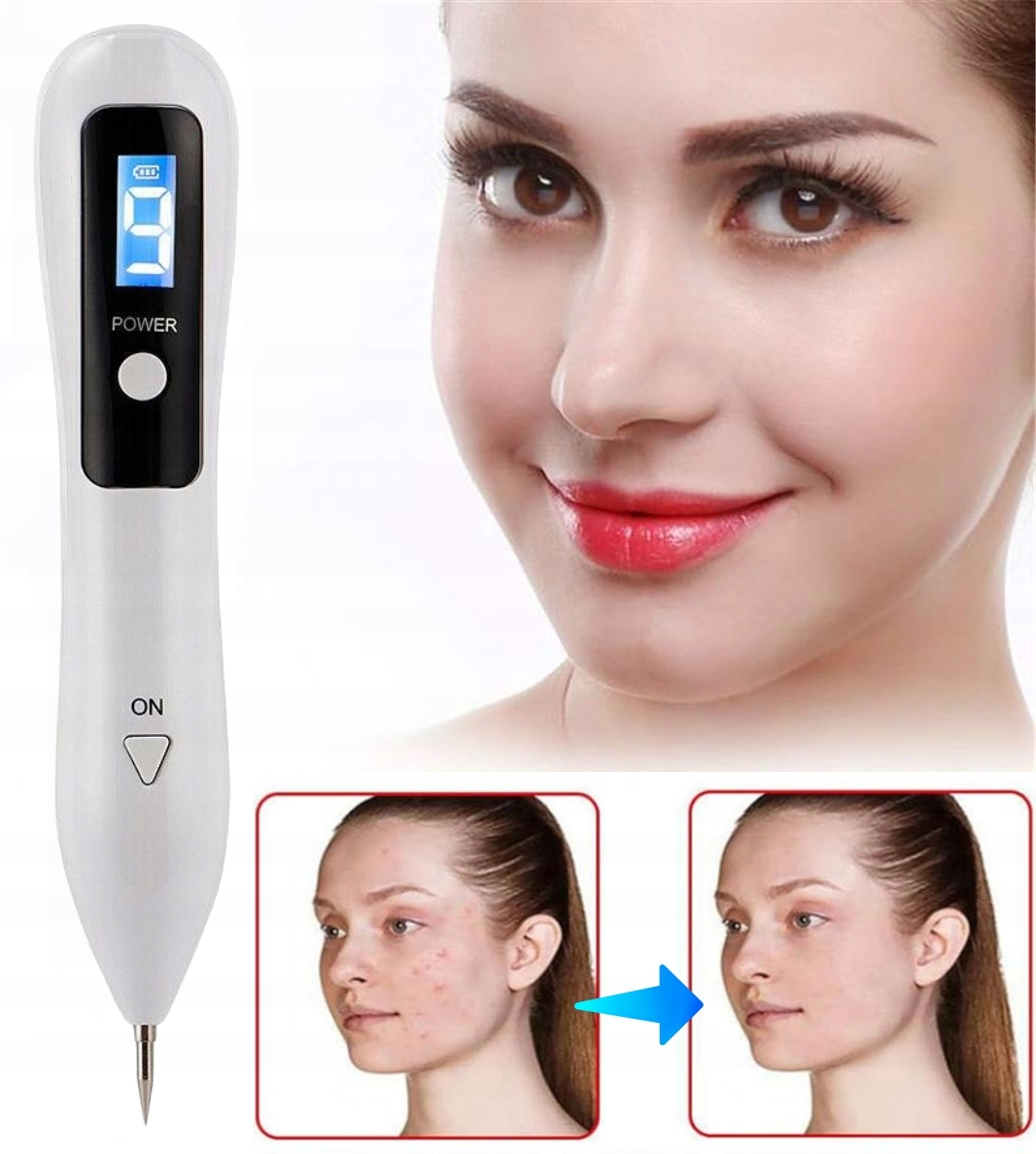 professional spot remover elektrokoagulator Laser pen Model Urządzenie plazmowe do rąk i ciała