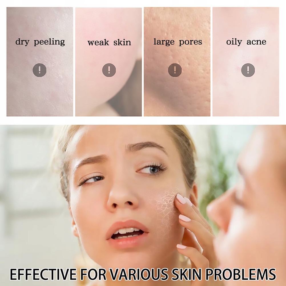 ŻEL ŁAGODZĄCY PO OPALANIU - OUHOE Pojemność 50 ml