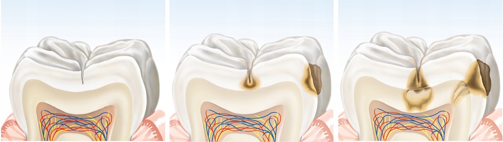 ELMEX Sensitive Whitening Pasta do zębów 75ml Wielkość Produkt pełnowymiarowy