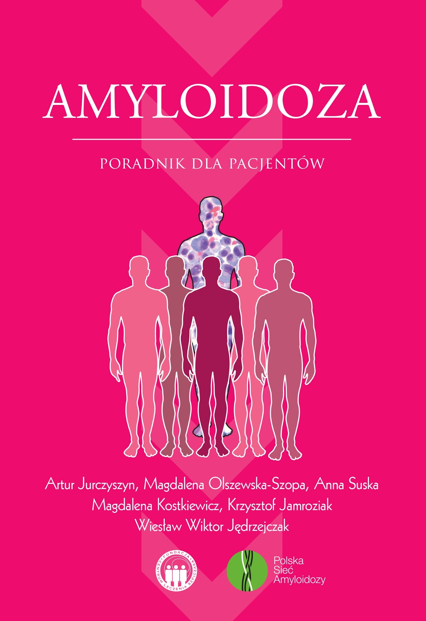 Amyloidoza