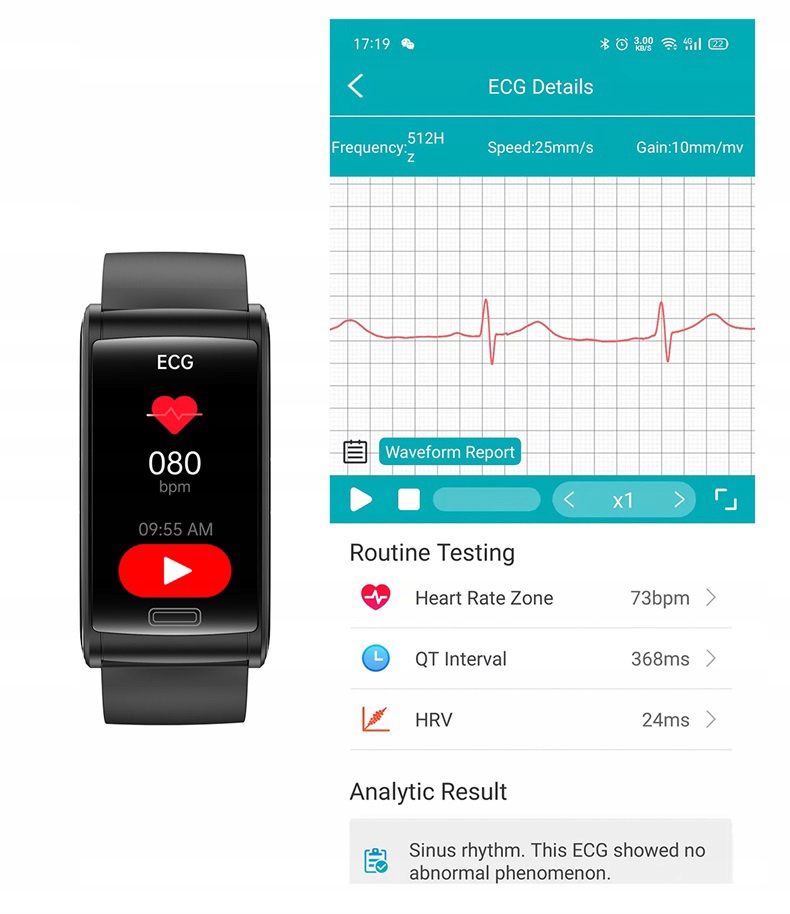 ZEGAREK OPASKA KARDIOWATCH Z ANALIZĄ POMIAREM CUKRU CIŚNIENIE PULS PAS EKG Kolor czarny
