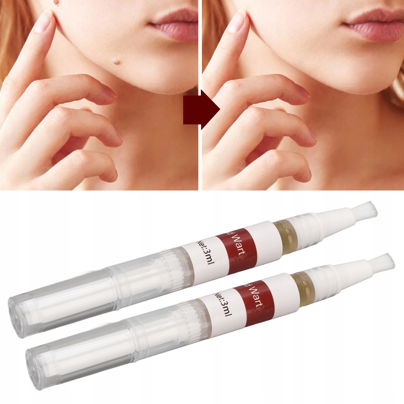 2X PŁYN DO USUWANIA BRODAWEK SKÓRY TAG 3ML Stan opakowania oryginalne