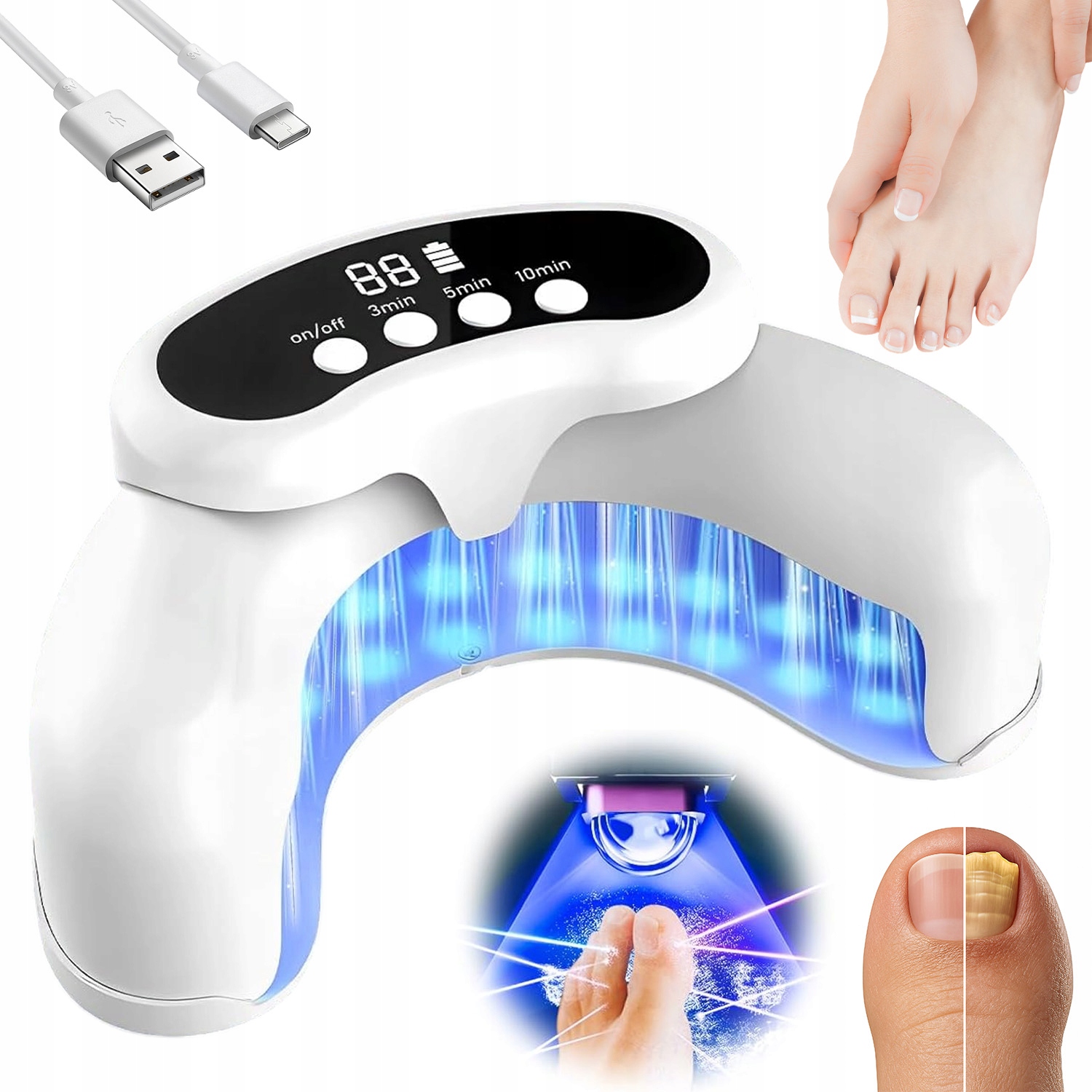 Laserové Zařízení Pro Léčbu Mykózy Nehtů, Bezbolestné, Účinné