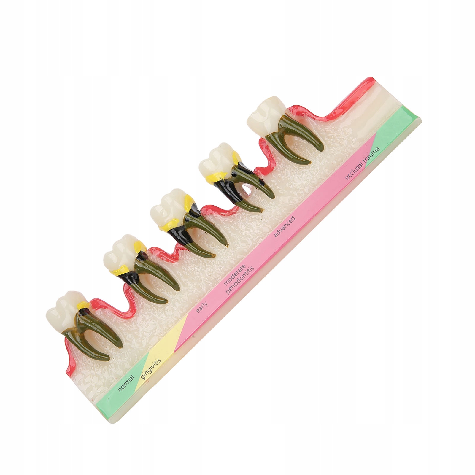 Model dentystycznych chorób przyzębia badanie choroby zębów Model 7W