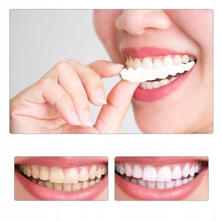 2xSZTUCZNE ZĘBY TYMCZASOWE KOSMETYCZNE NAKŁADKI Kod producenta 878ooo