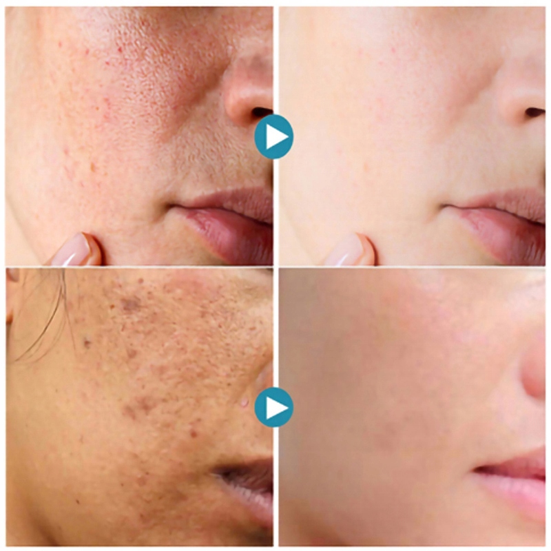 Serum do twarzy przeciwzmarszczkowe Marka inna