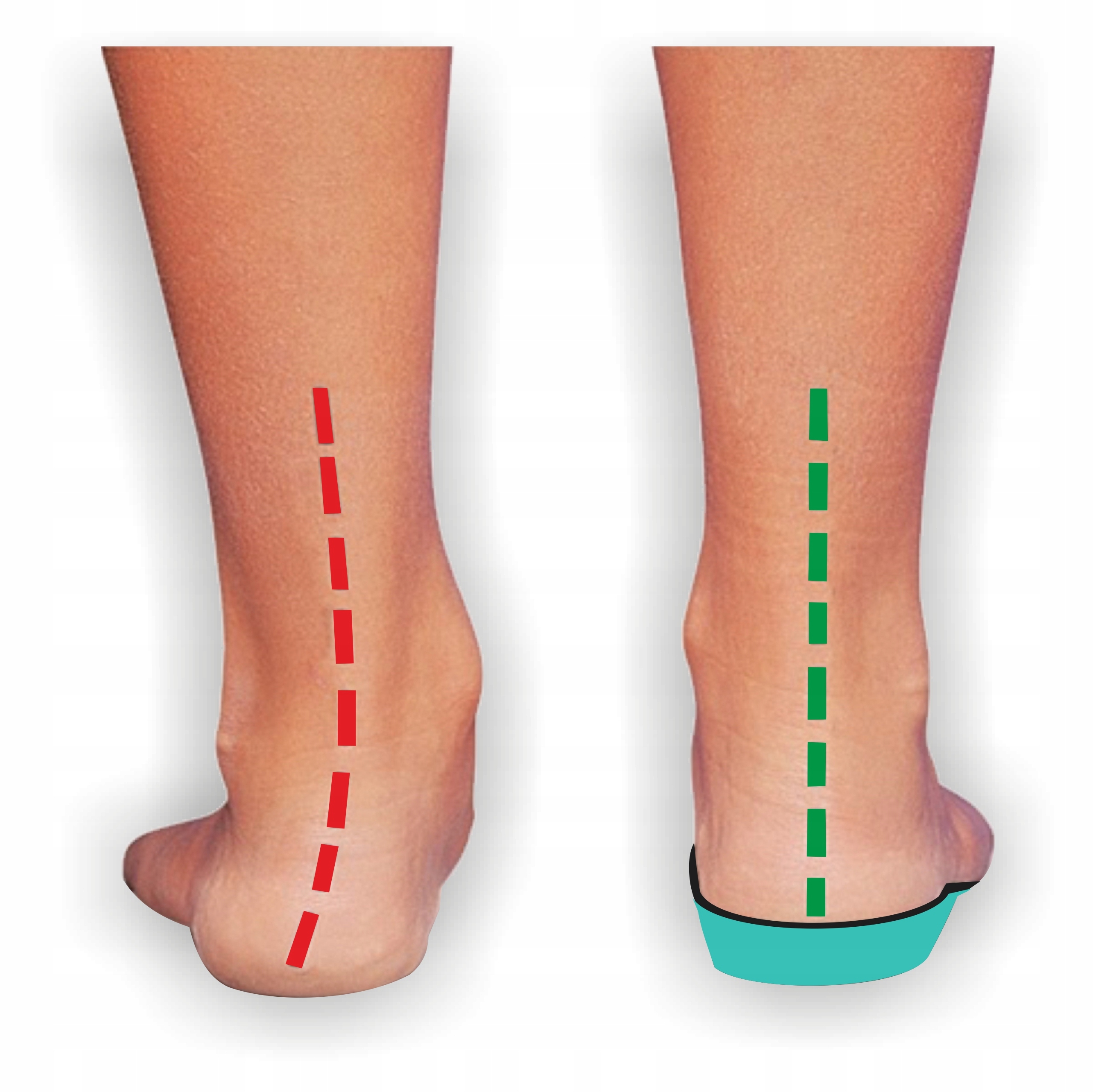 WKŁADKI DO BUTÓW DZIECIĘCE PROFILOWANE SUPINUJĄCE EVA 26/28 Marka Corbby