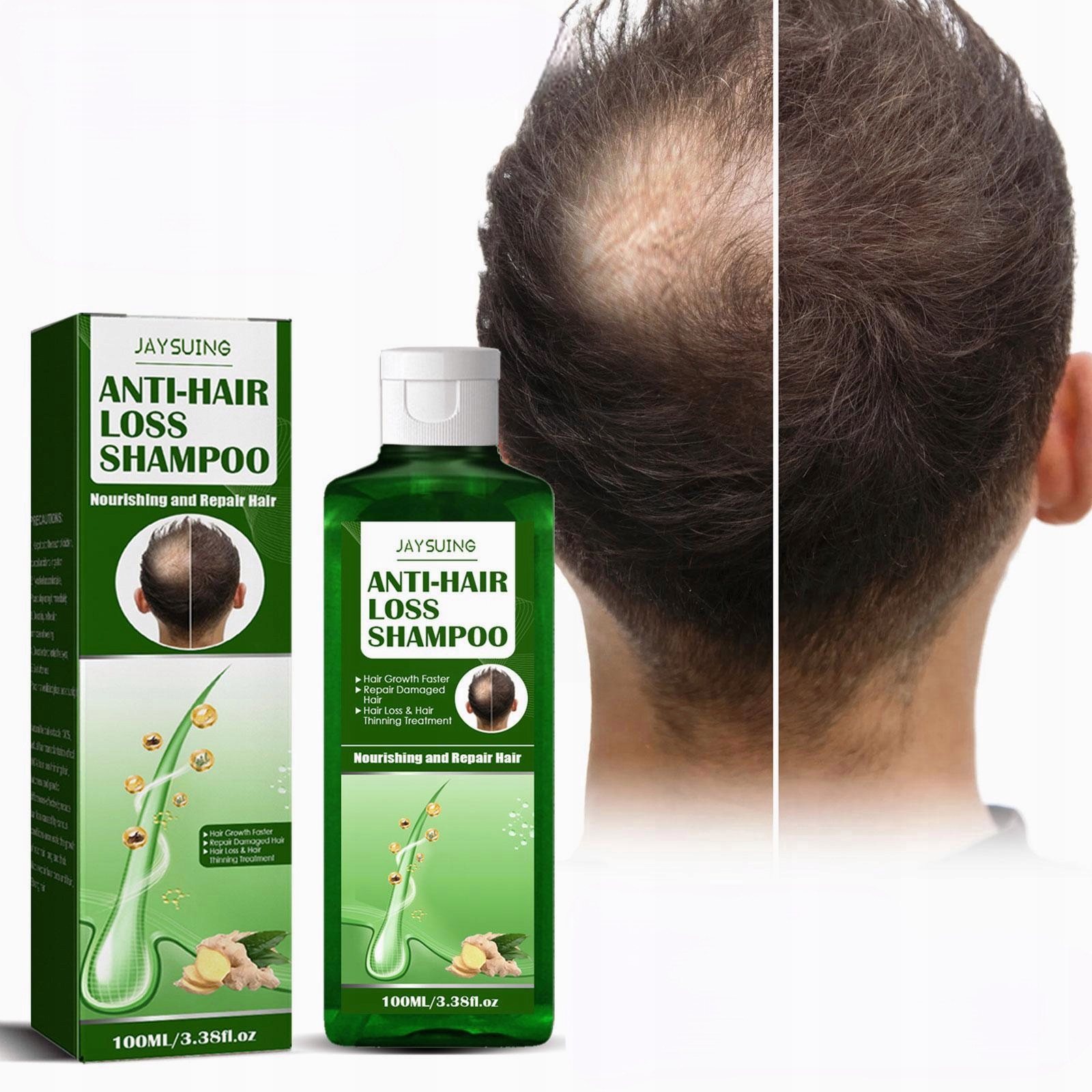 Anti-utrata Włosów Szampon Imbirowy Promowanie