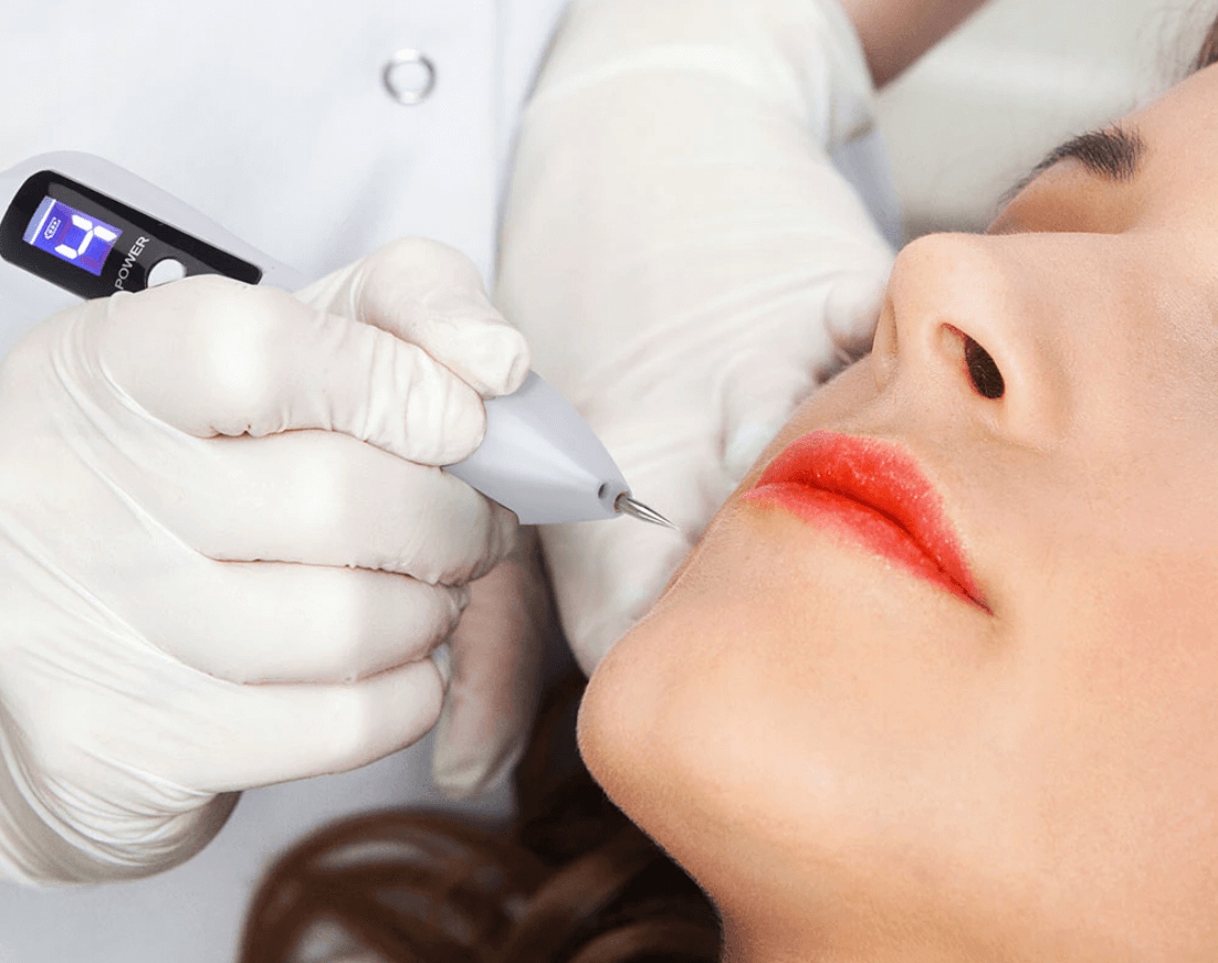 PLASMA PEN - Plazma Kosmetyczna na Brodawki i Kurzajki, Skuteczne Usuwanie. Model 5905378115187