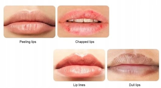 HUDA BEAUTY Maseczka na USTA Żelowa AVOCADO 20 szt Marka Huda Beauty