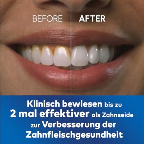 WATERPIK Ultra Profesjonalny Irrygator Do Zębów, 7 Końcówek, Niebieski — miniatura 5