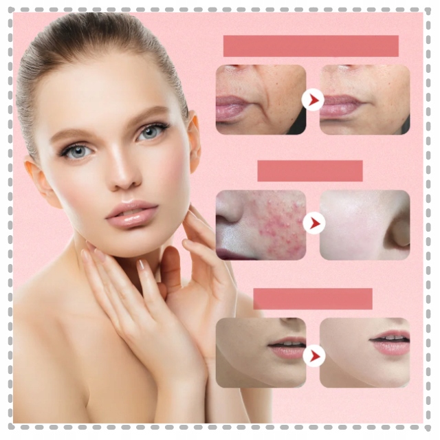 MASAŻER TWARZY BEZIGŁOWY 7W1 MEZOTERAPIA BEZIGŁOWA TERAPIA ŚWIATŁEM LIFTING Model 7in1