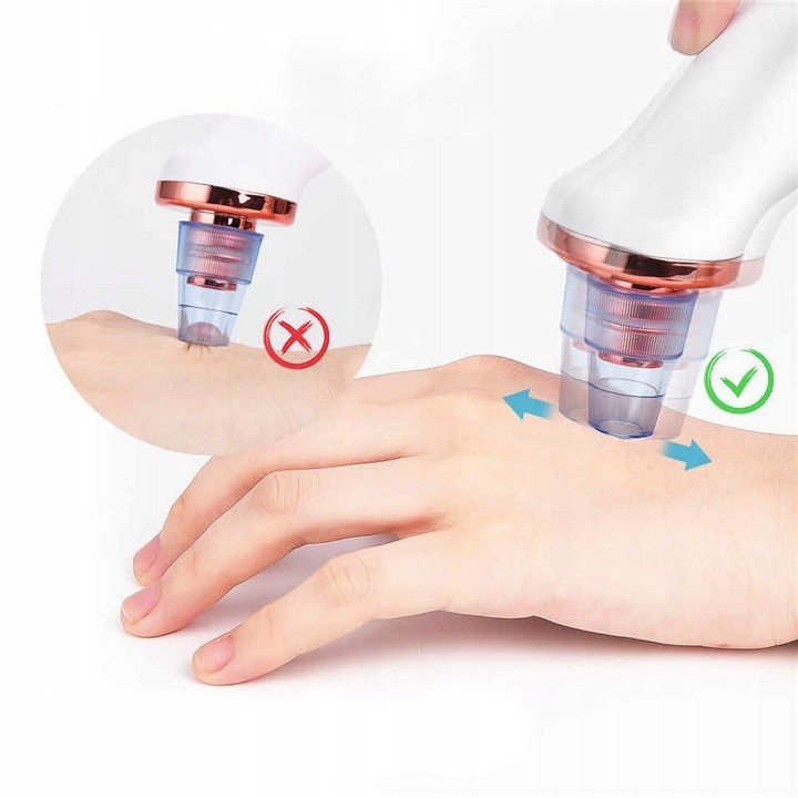 ODKURZACZ WĄGRÓW MIKRODERMABRAZJA DIAMENTOWA 4w1 Wyrób medyczny nie