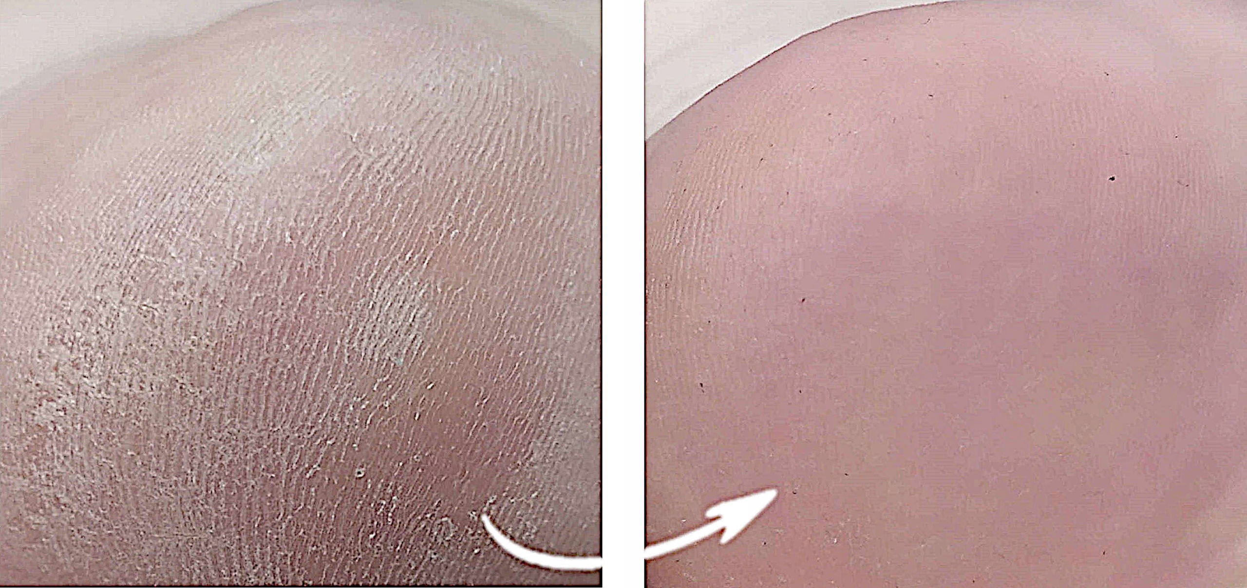 Ag Preparat do stóp przeciwgrzybiczy SPRAY 3x100ml Rodzaj serum