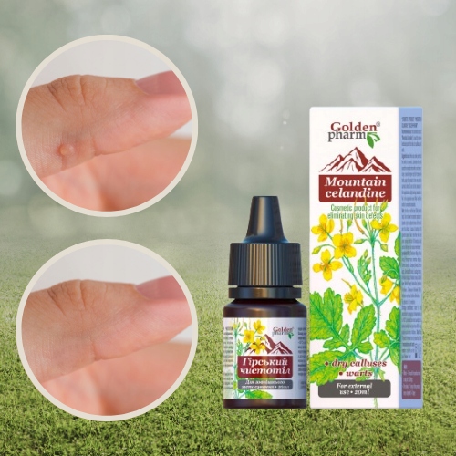 GLISTNIK GÓRSKI JASKÓŁCZE ZIELE WŁÓKNIAKI KURZAJKI BRODAWKI MODZELE 20 ml Rodzaj płyn