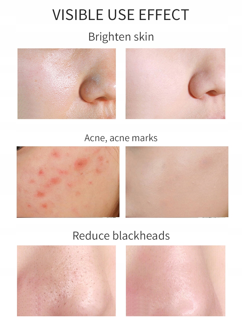 MELAO 100ml witamina C płyn do demakijażu kon Rodzaj Drobnoziarnisty