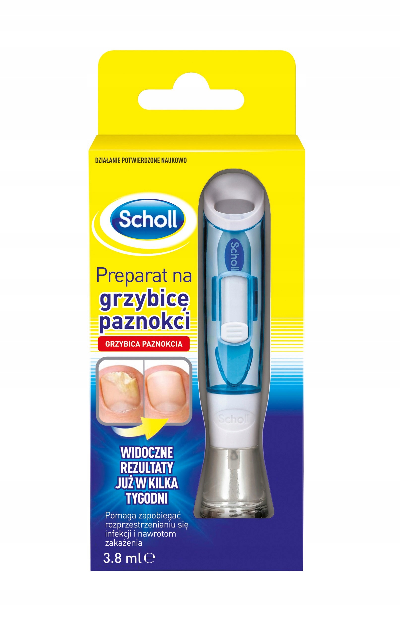 Scholl Protiplísňový přípravek na nehty 3,8 ml – Účinná ochrana