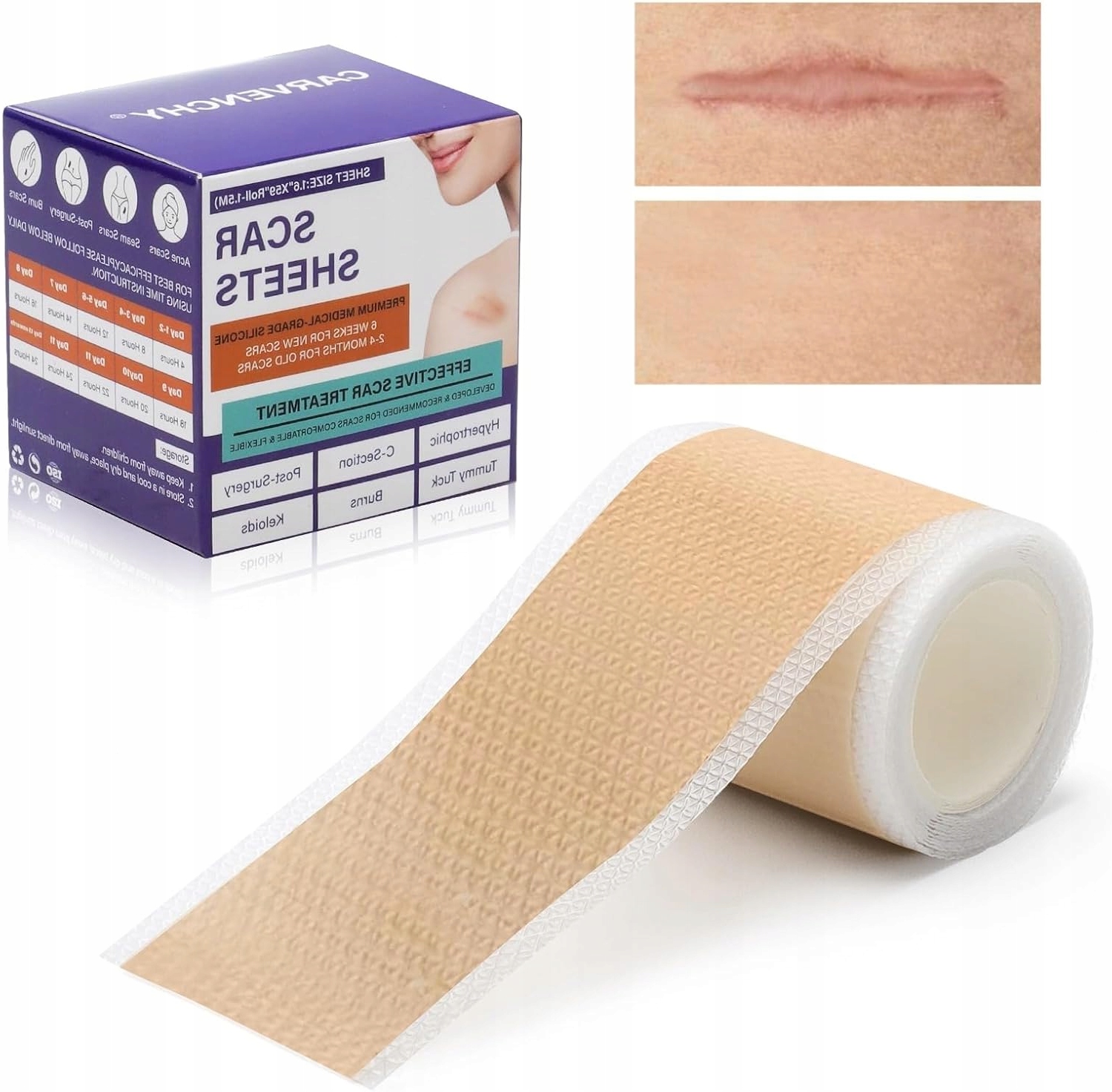 Silikonová Náplast Na Jizvy, Víceúčelová Páska, Role 1,5 M