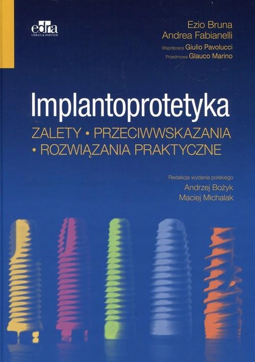 Implantoprotetyka Zalety Przeciwwskazania...