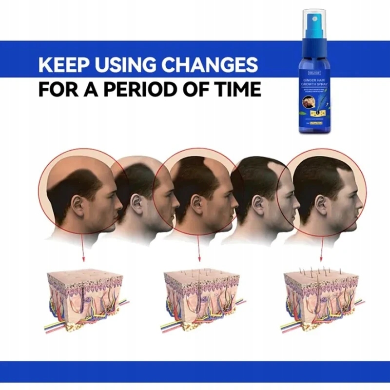 Spray na porost włosów z ekstraktem z imbiru, Pojemność 30 ml