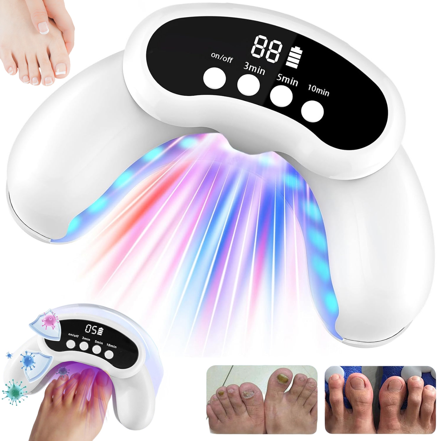 Laserové Protiplísňové Zařízení Proti Plísním, Mykóza Nehtů 470NM+905NM 2000mAh