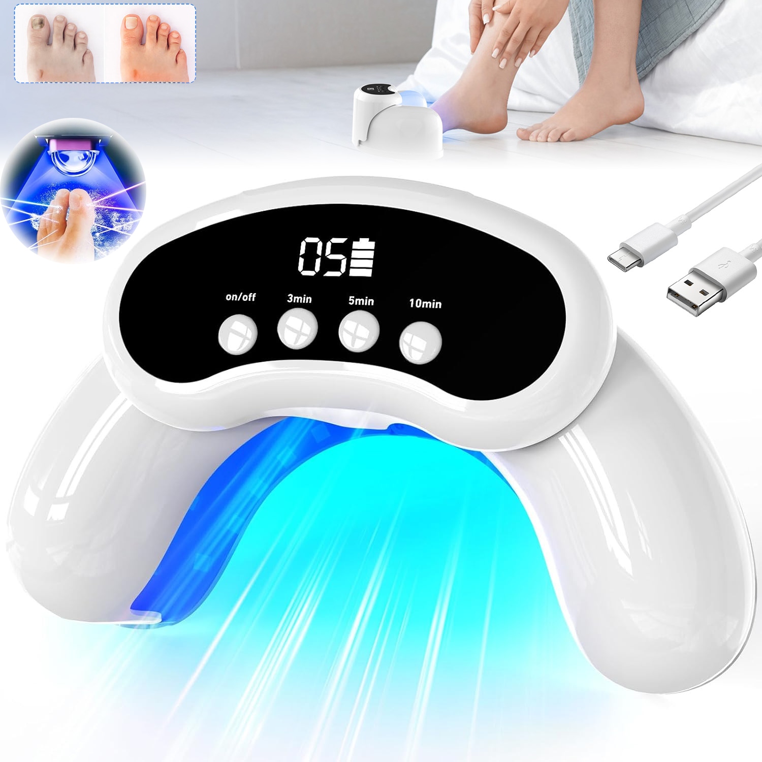 Lampa Na Mykózu Nehtů Účinná Laserová Léčba Světelnou Terapií