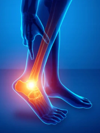 STABILIZATOR OPASKA KOMPRESYJNA ŚCIĄGACZ STAWU SKOKOWEGO KOSTKI STOPY Rozmiar XL