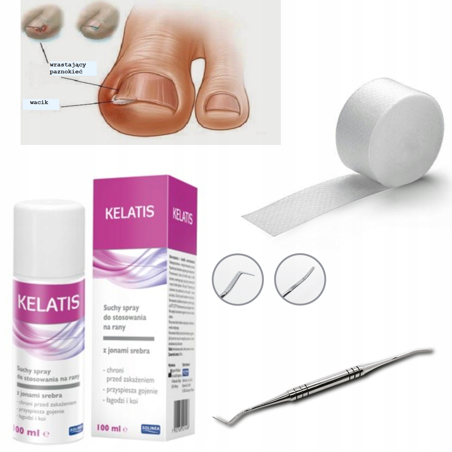 WRASTAJĄCE PAZNOKCIE Kelatis Tamponada Sonda Rodzaj zestaw