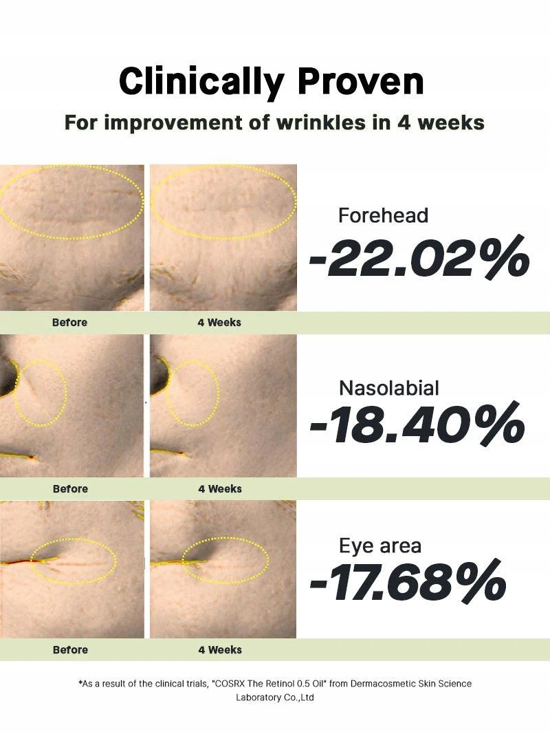 COSRX The Retinol 0.5 Oil, 20 ml Działanie przeciw niedoskonałościom