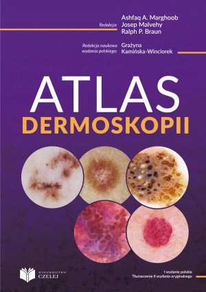 Atlas dermoskopii