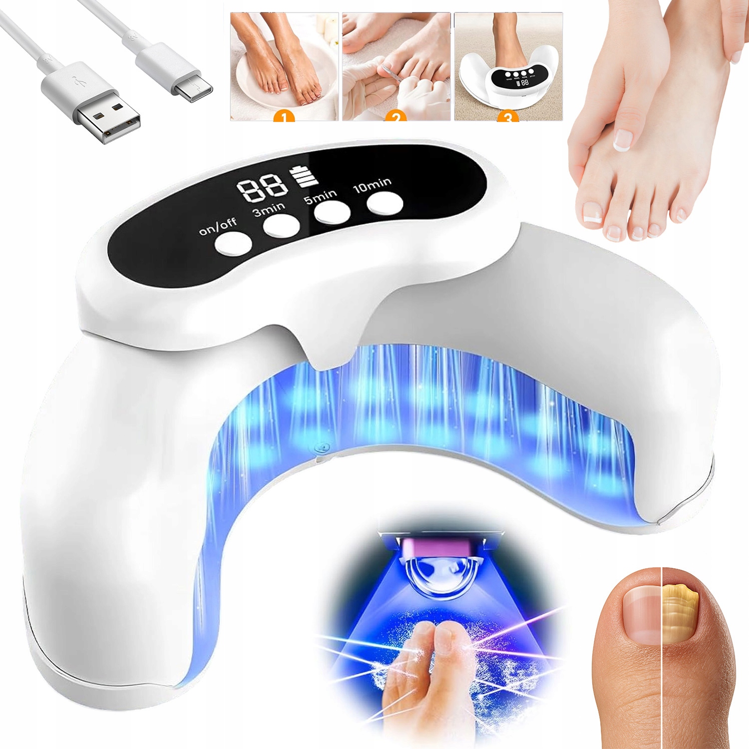 Zařízení Pro Léčbu Mykózy Nehtů Domácím Laserem Se Dvěma Vlnami