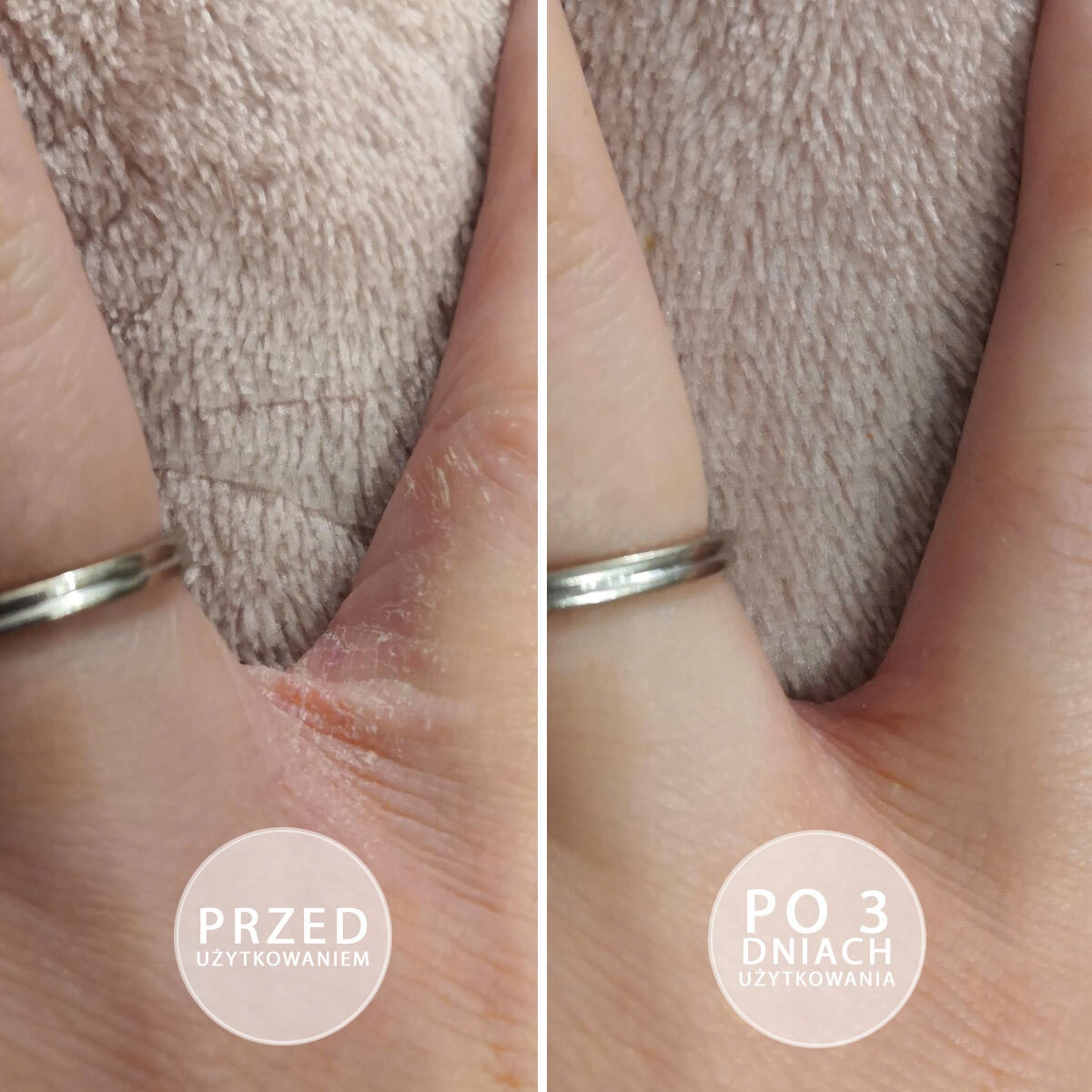 Maść z witaminą E do rąk, do skóry suchej BEAUTICA natłuszczająca SOS 100ml Zapach truskawkowy