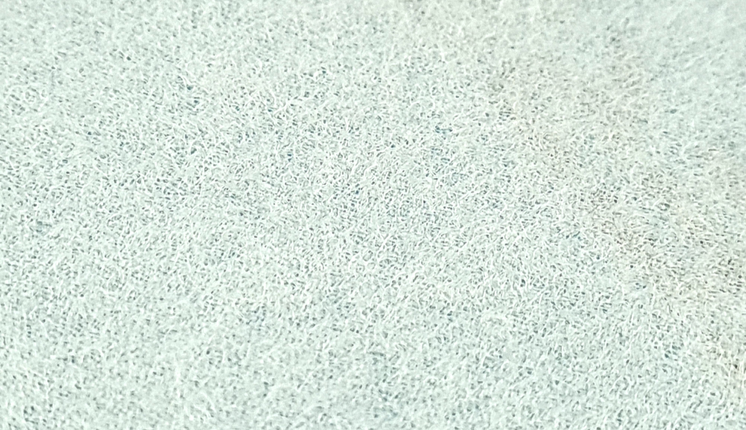 KRĄŻEK ŚCIERNY NA RZEP 150 MM 17 OTWORÓW P150 x5 Gradacja P150