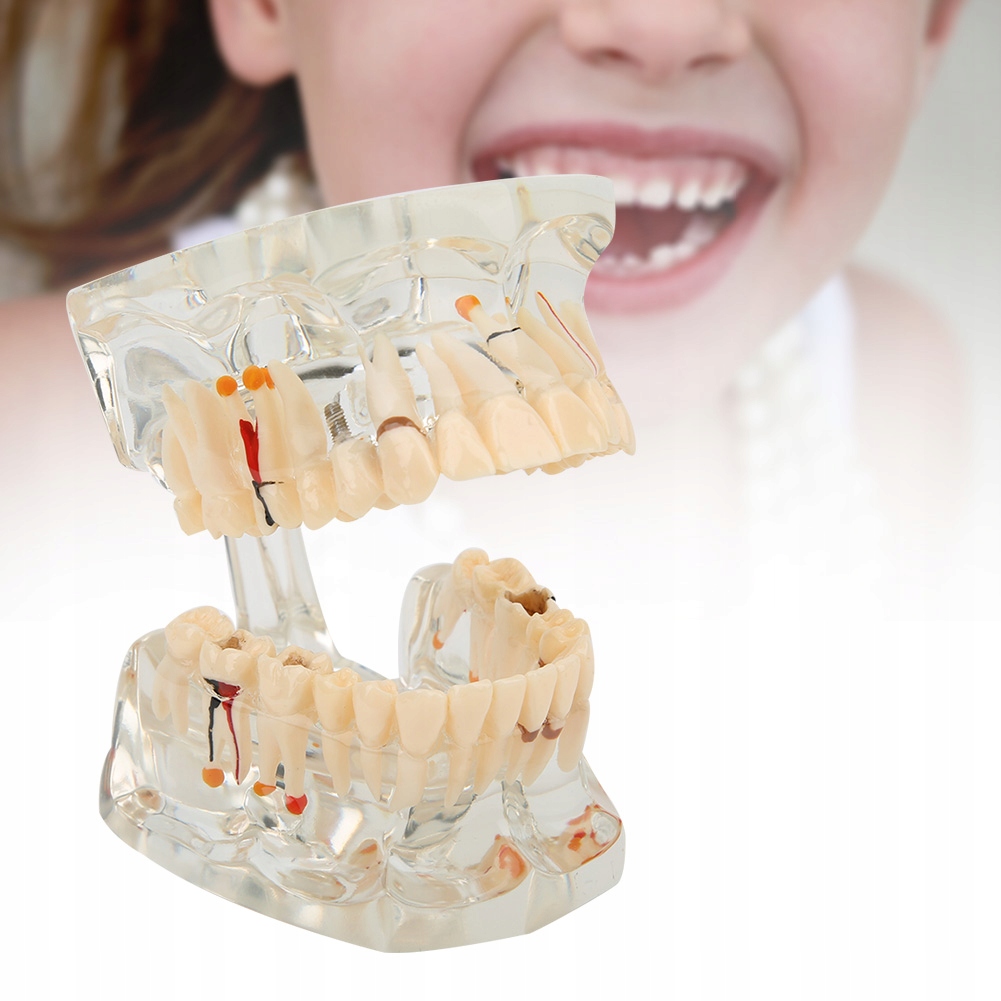 MODEL STOMATOLOGICZNY SZCZĘKA ZĘBY ZĘBOWY SLAMY Marka bez marki