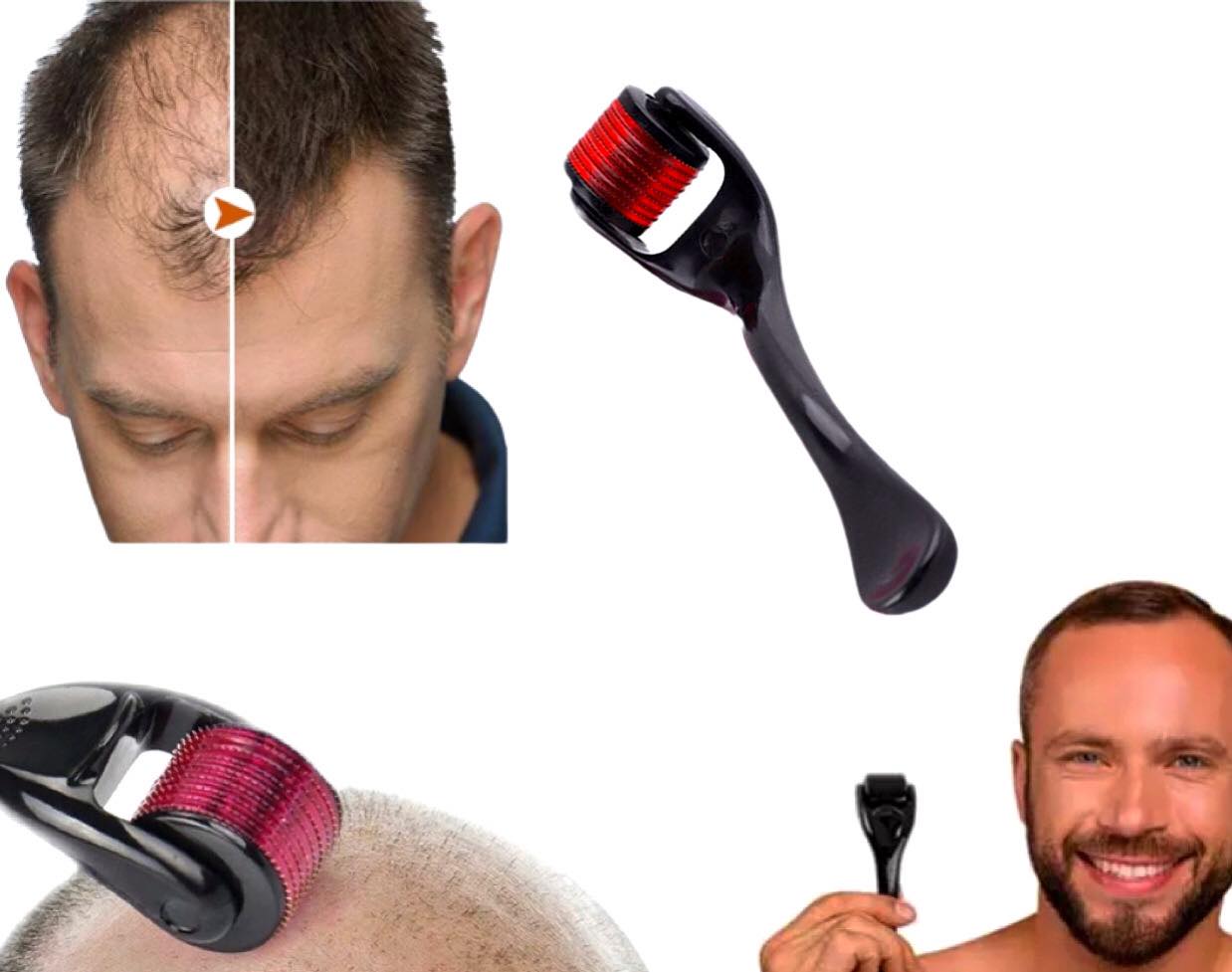 ROLLER DO BRODY WŁOSÓW MEZOTERAPIA WŁOSÓW POROST