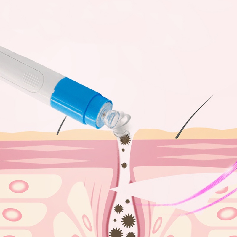 ODKURZACZ DO WĄGRÓW ZASKÓRNIKÓW MIKRODERMABRAZJA EAN (GTIN) 5907451308127