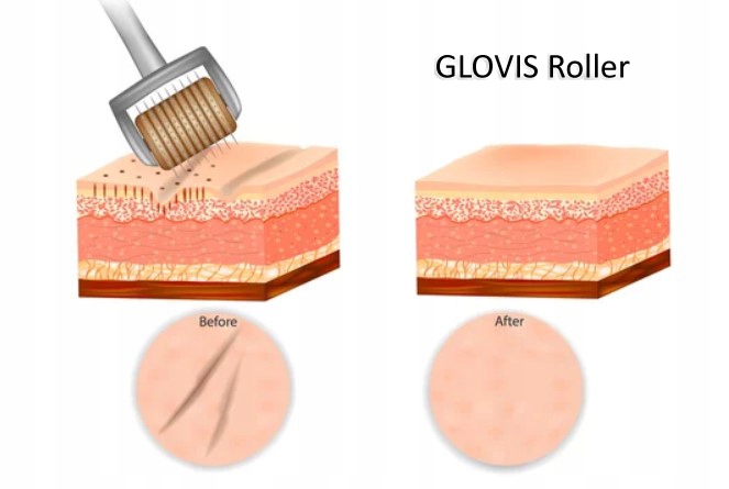 GLOVIS ROLLER 0.5mm do Twarzy Wygładza Zmarszczki Zasilanie brak