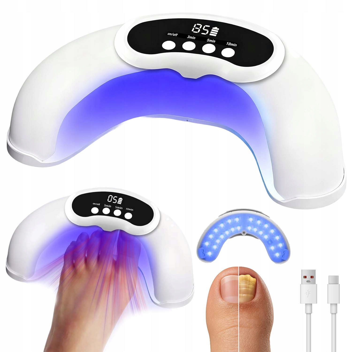 Protiplísňové Laserové Zařízení Pro Léčbu Mykózy Nehtů Na Nohou