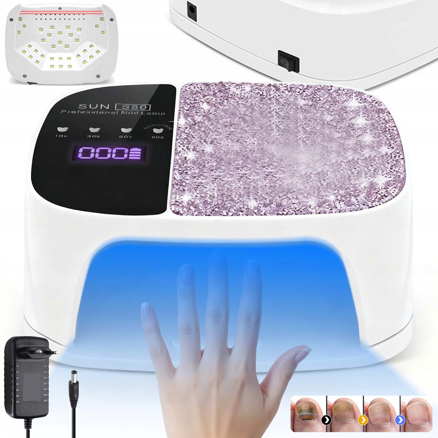 Laserové Zařízení Pro Léčbu Mykózy Rukou A Nohou, Bezpečné A Rychlé