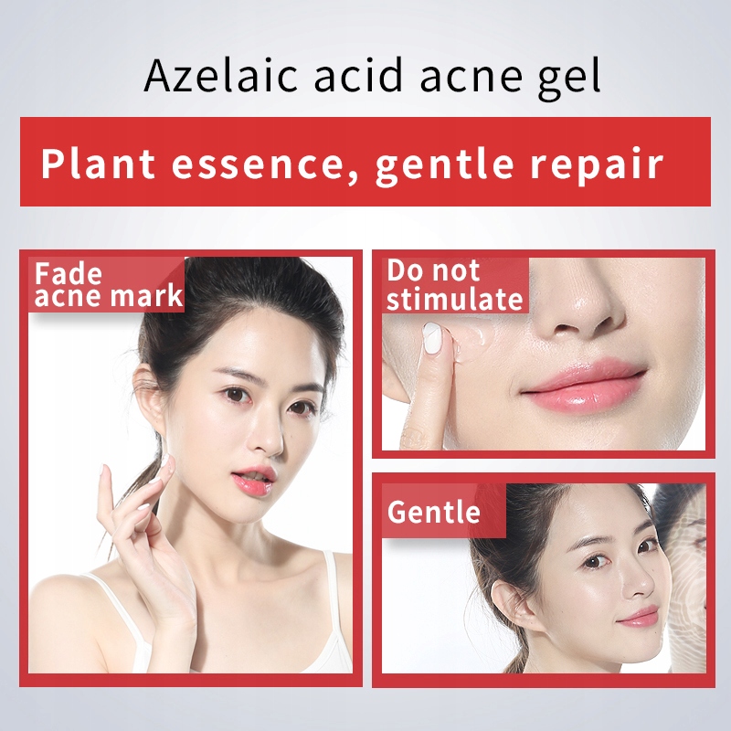 Azelaic Acid Anti-Acne Gel Loại mụn ngày và đêm