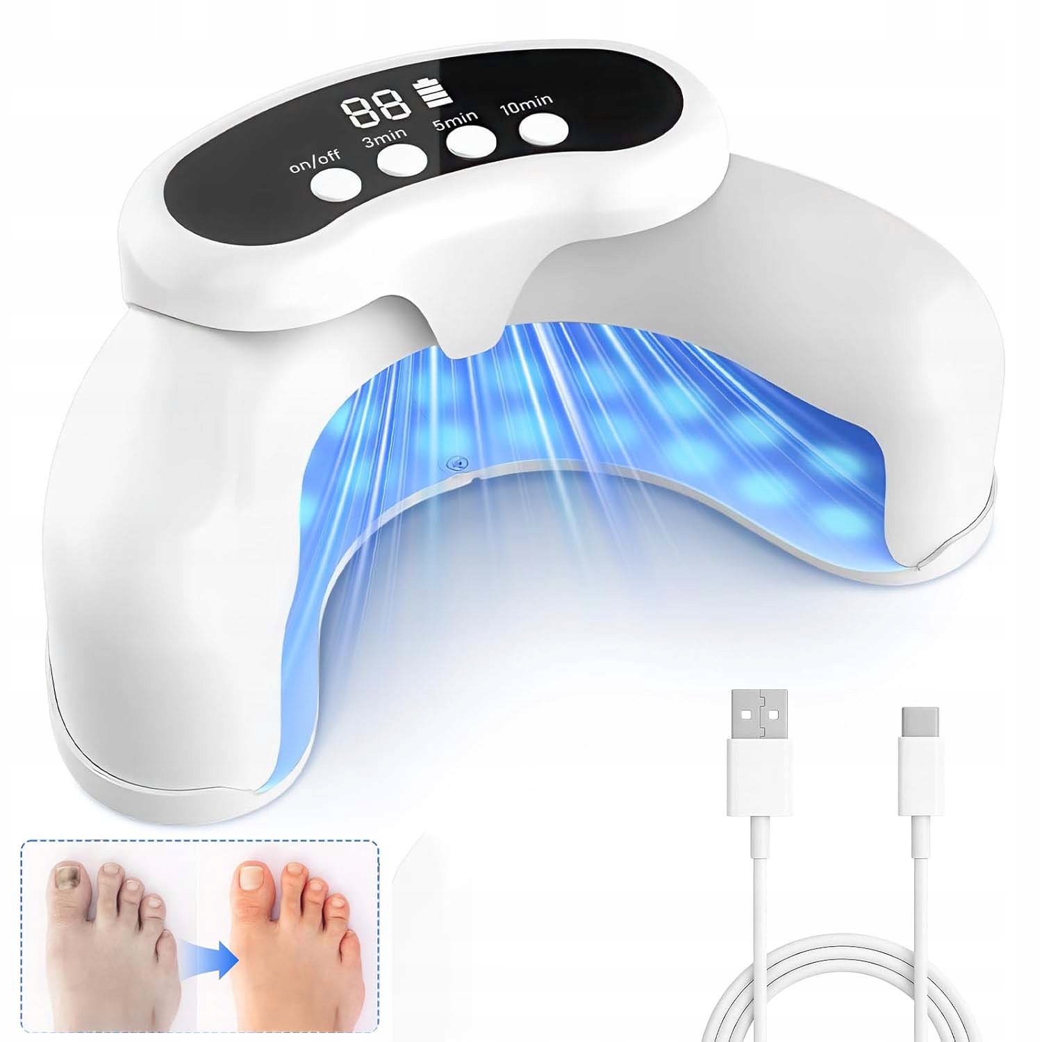 Zařízení Pro Léčbu Mykózy Nehtů Proti Laserové Světelné Terapii, Lampa