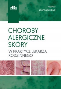 

Choroby Alergiczne Skóry W Praktyce Lekarza Rodzin