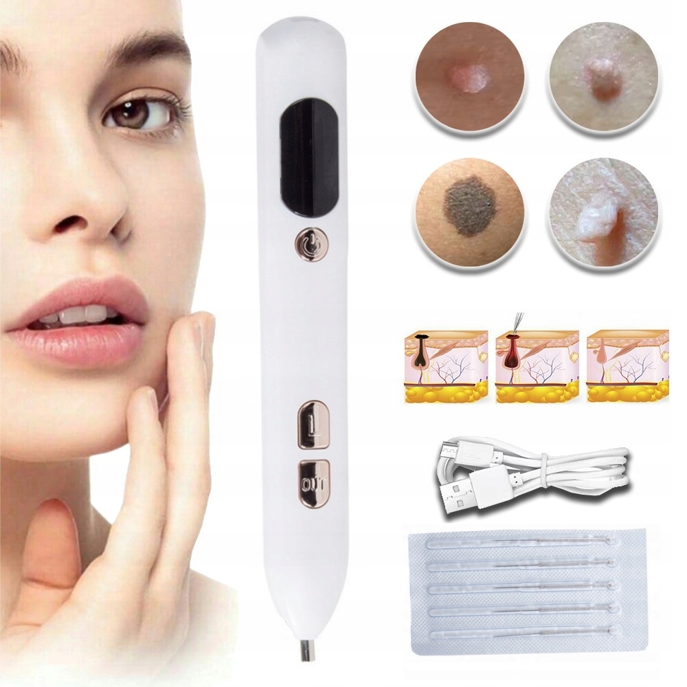 Plazma Pen – Odstraňování Bradavic Z Vlákniny, Akumulátor, 9 Úrovní Výkonu