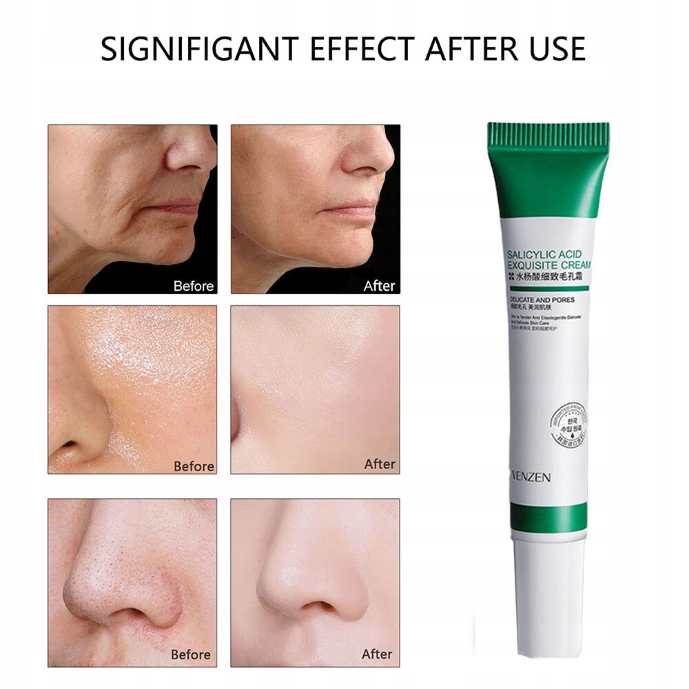 KWAS SALICYLOWY OBKURCZAJĄCY PORY KREM NAWILŻ Kod producenta JJF-518WI