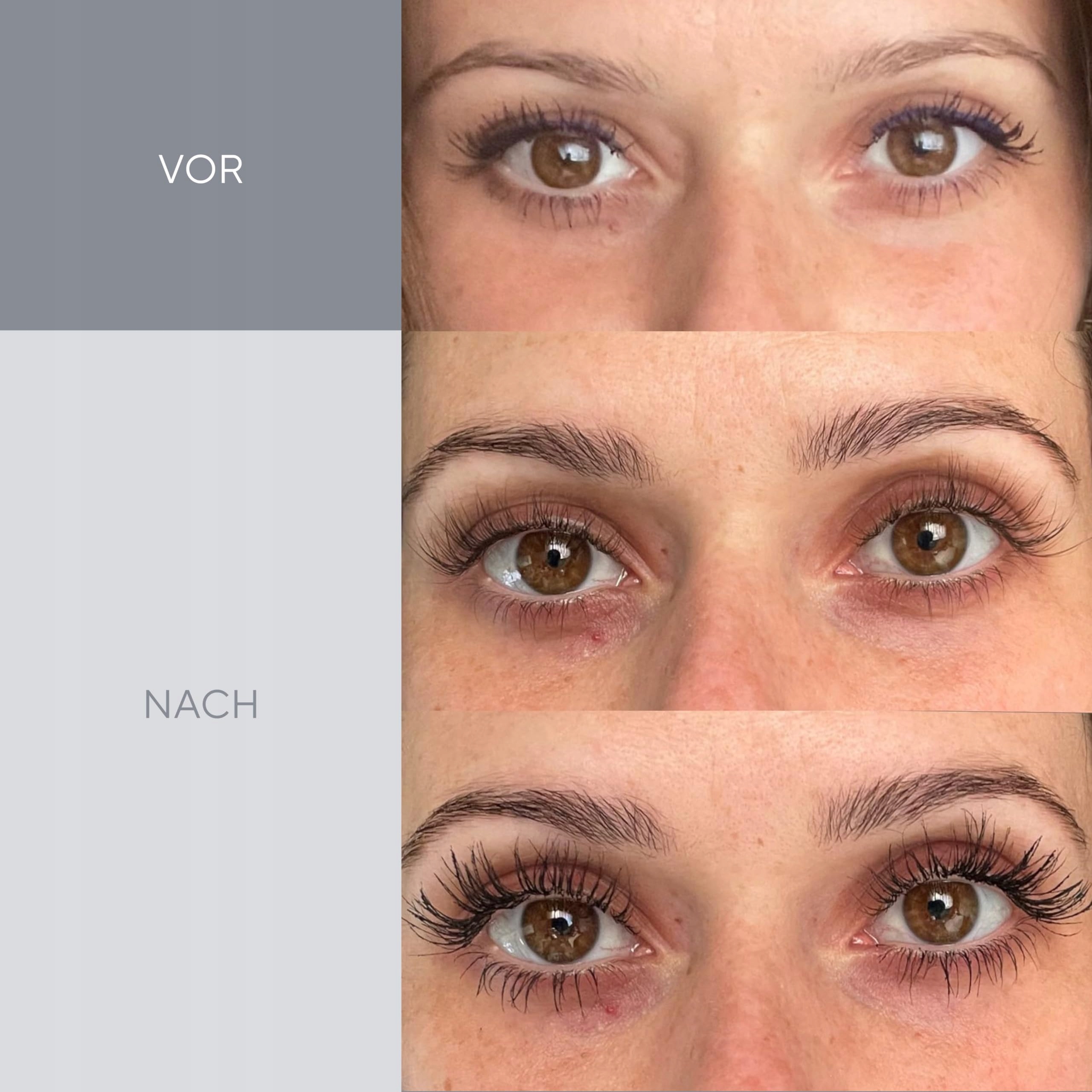 LONG4LASHES Serum Do Rzęs Wzrostu 60 Dni Kuracja 15 ml Testowane Klinicznie — miniatura 6